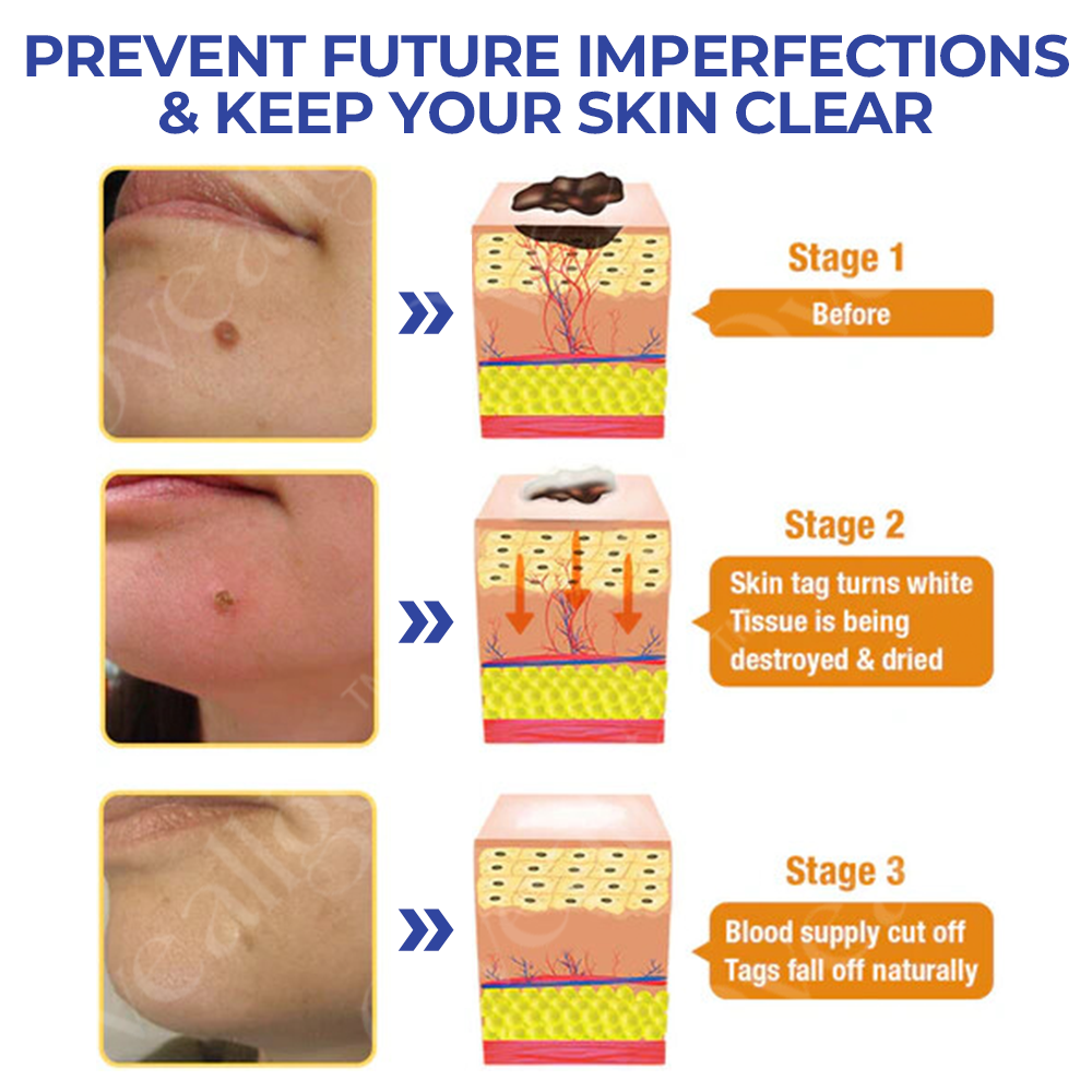 ApisThera™ TagRecede Bee Venom Treatment Spray