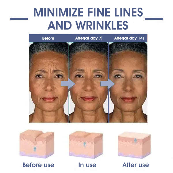 ATTDX™ Advanced Firming and Wrinkle Reducing Cream