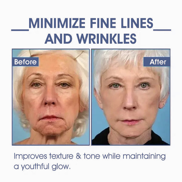 ATTDX™ Advanced Firming and Wrinkle Reducing Cream