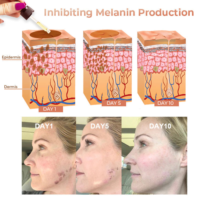 ApisDerm™ Melanin Correcting Facial Serum