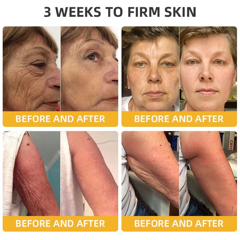 ATTDX® BeeLift Anti-Aging Firming Cream