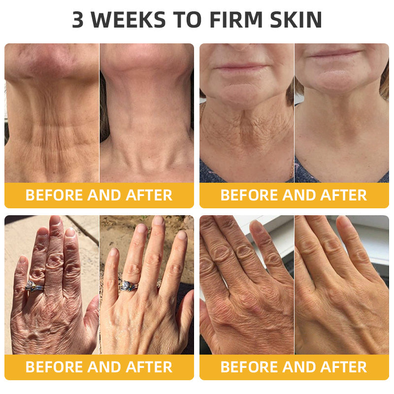 ATTDX® BeeLift Anti-Aging Firming Cream