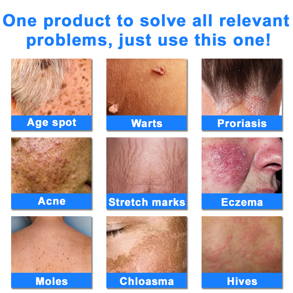 ATTDX® C+ Skin Dermatitis Cream