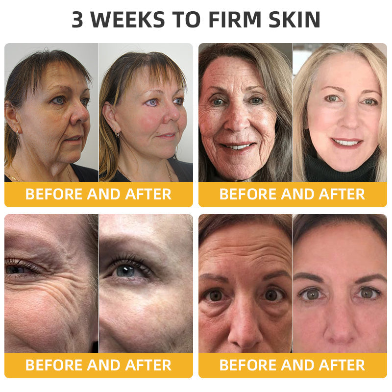 ATTDX® BeeLift Anti-Aging Firming Cream