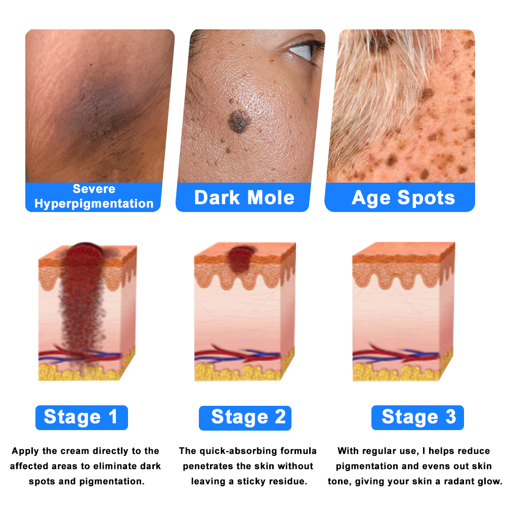 ATTDX® C+ Skin Dermatitis Cream