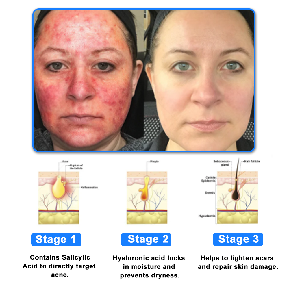 ATTDX® C+ Skin Dermatitis Cream