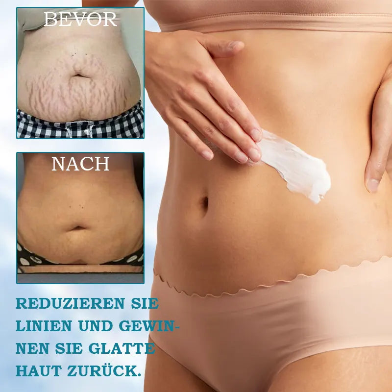 ATTDX™ Advanced Firming and Wrinkle Reducing Cream