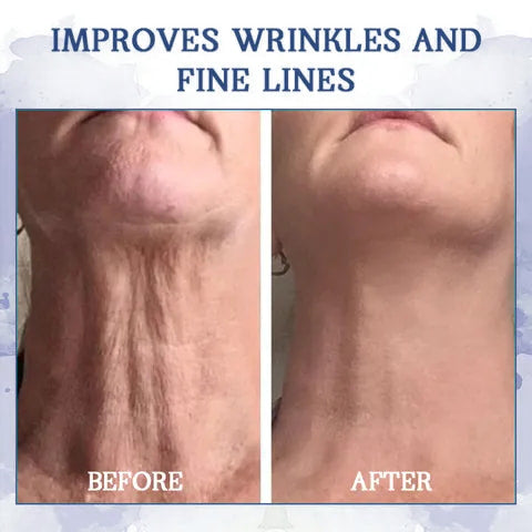 ATTDX™ Advanced Firming and Wrinkle Reducing Cream
