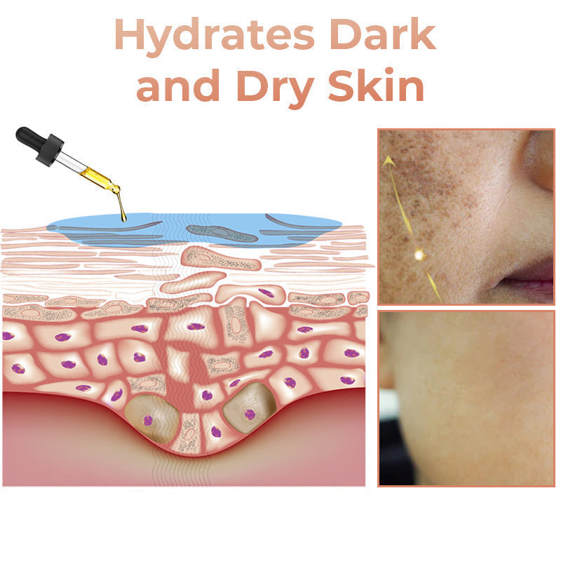 ApisDerm™ Melanin Correcting Facial Serum