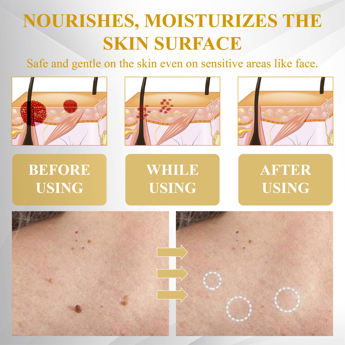 ATTDX® ApisCare Blemish & Tag Remover Stick