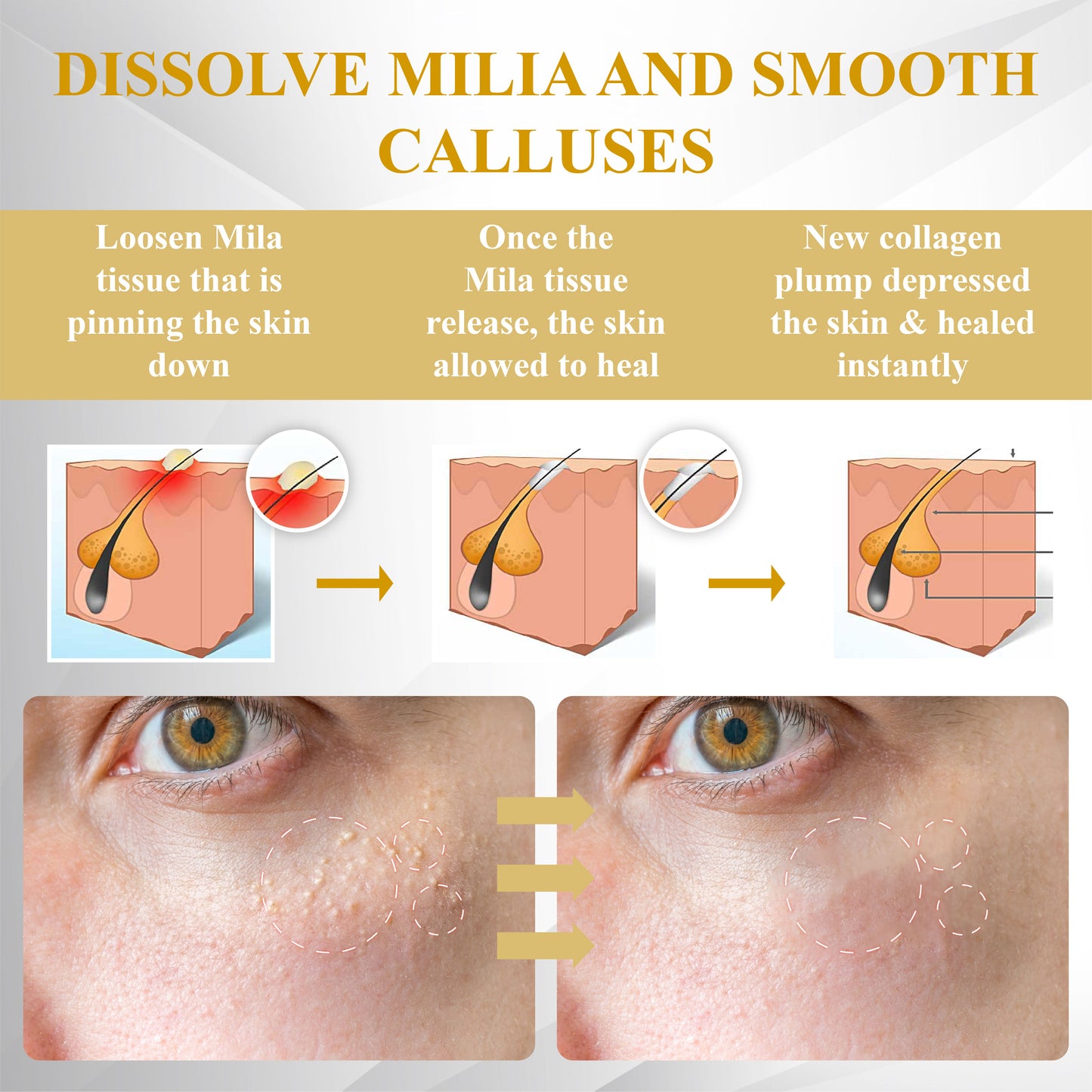 ATTDX® ApisCare Blemish & Tag Remover Stick