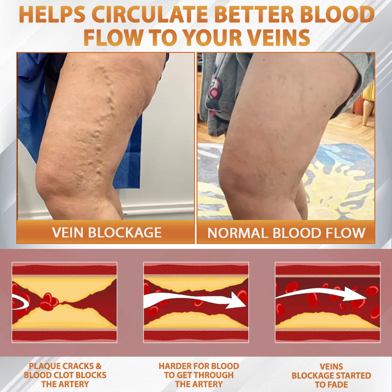 ATTDX® Apis Venom Vein Soothing Cream
