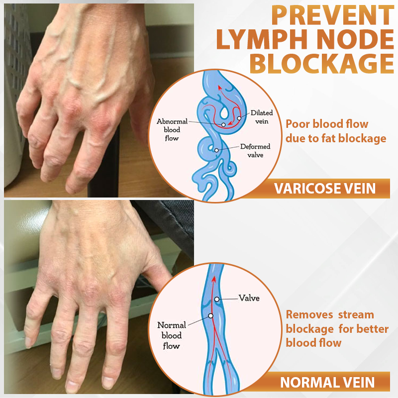 ATTDX® Apis Venom Vein Soothing Cream