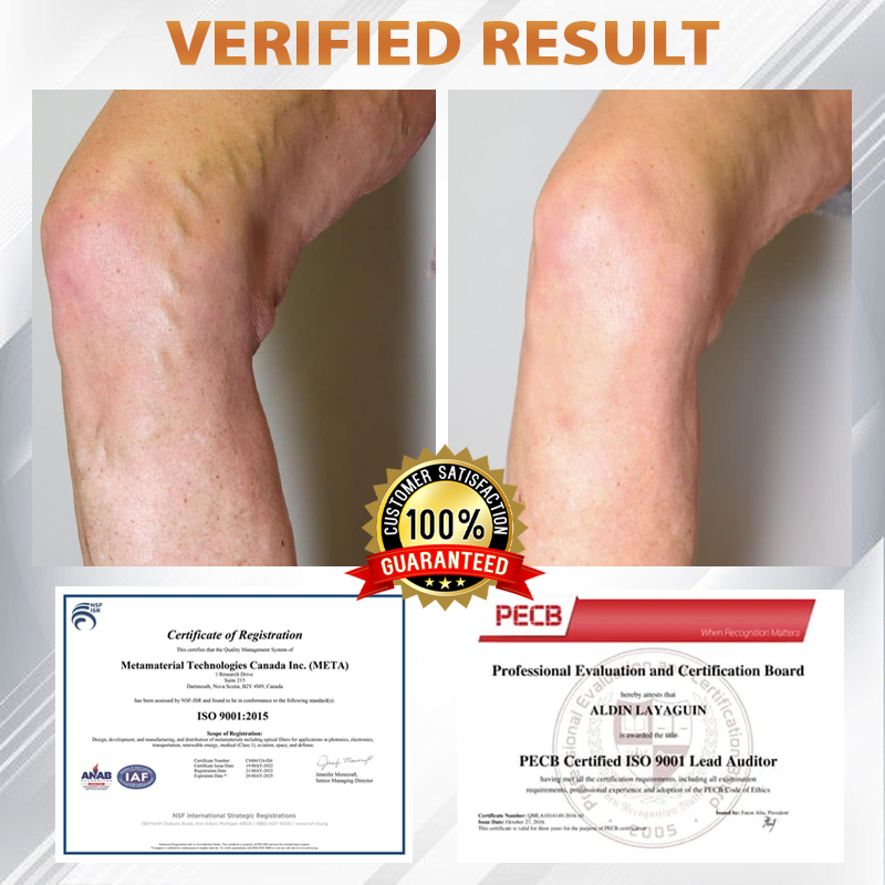 ATTDX® Apis Venom Vein Soothing Cream