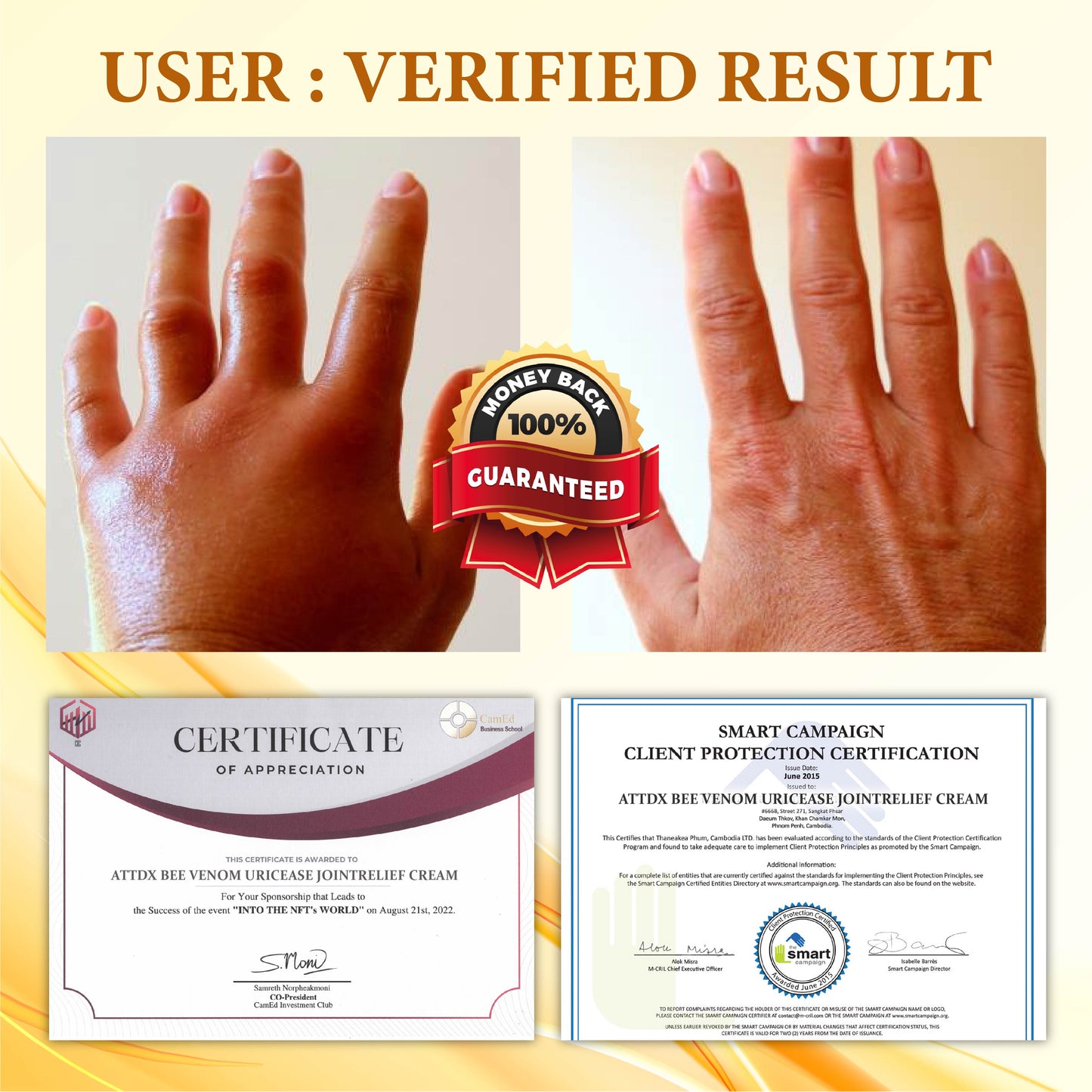 ATTDX™ Bee Venom UricEase JointRelief Cream