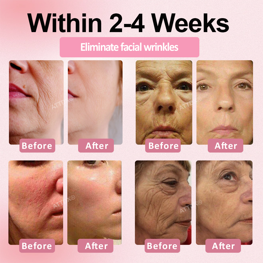 ATTDX® Botox-Tech Serum Infused Micro Dart Patch