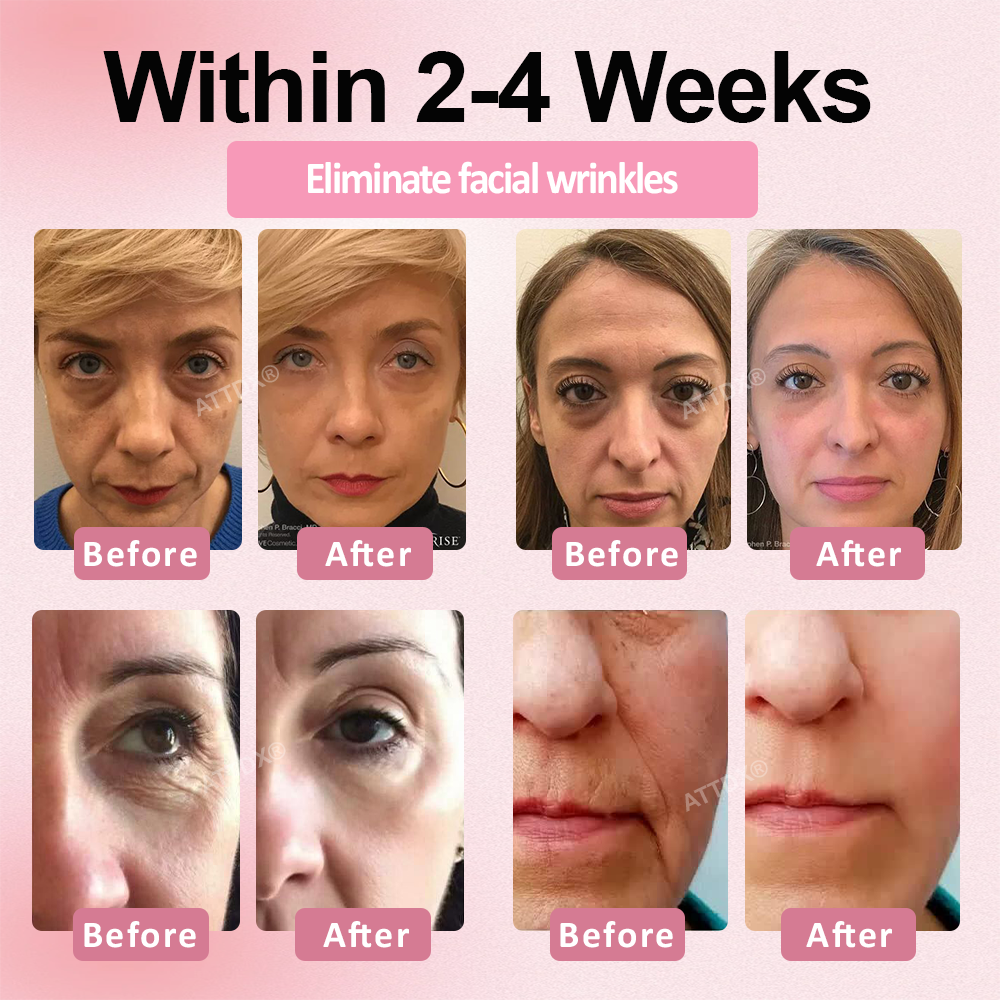 ATTDX® Botox-Tech Serum Infused Micro Dart Patch