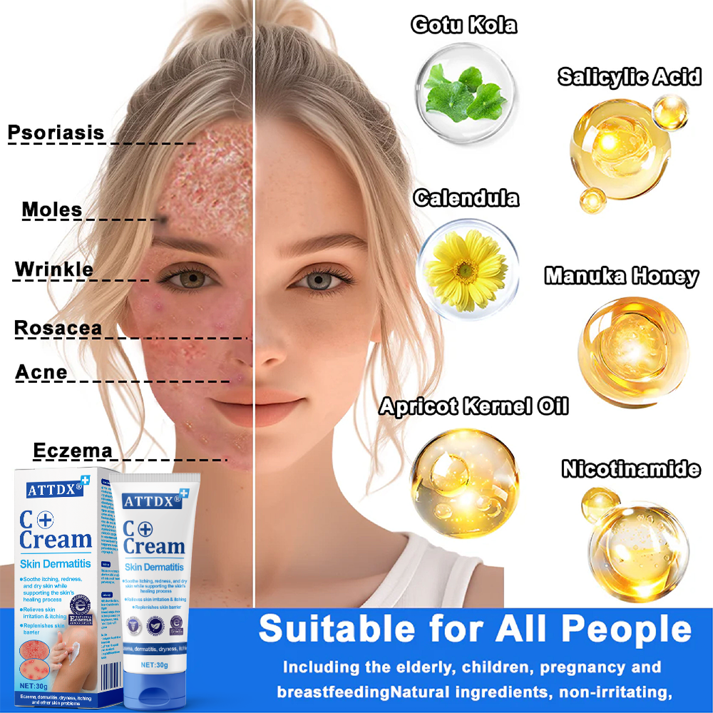 ATTDX® C+ Skin Dermatitis Cream