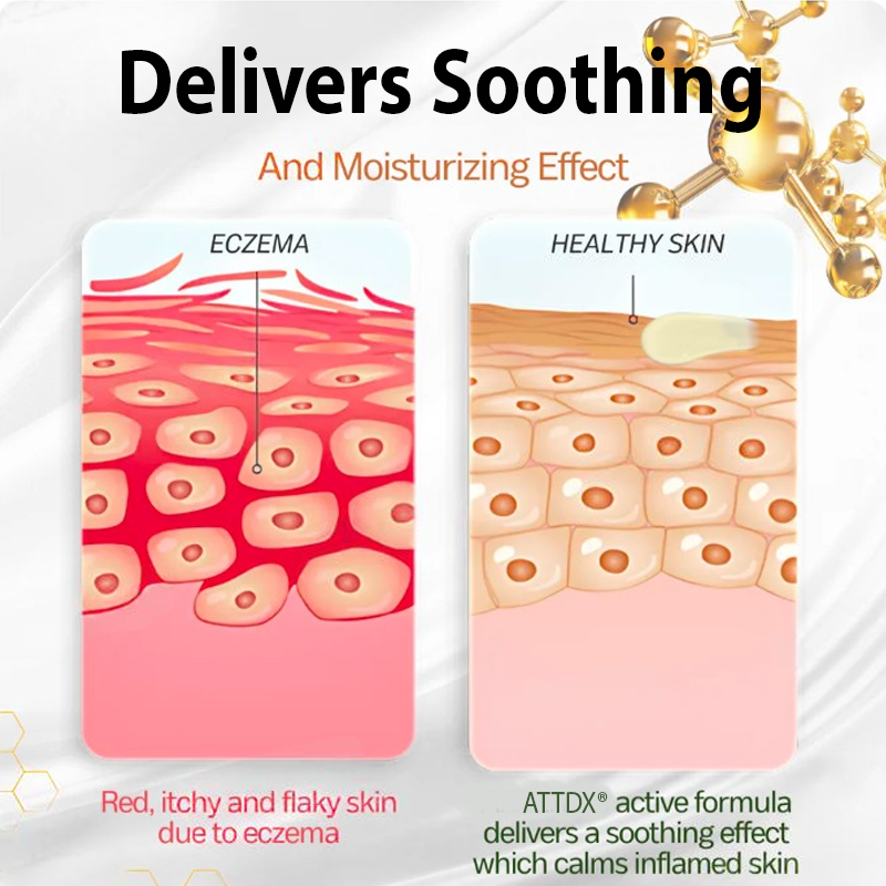 ATTDX® Eczema Relief Manuka Honey Cream