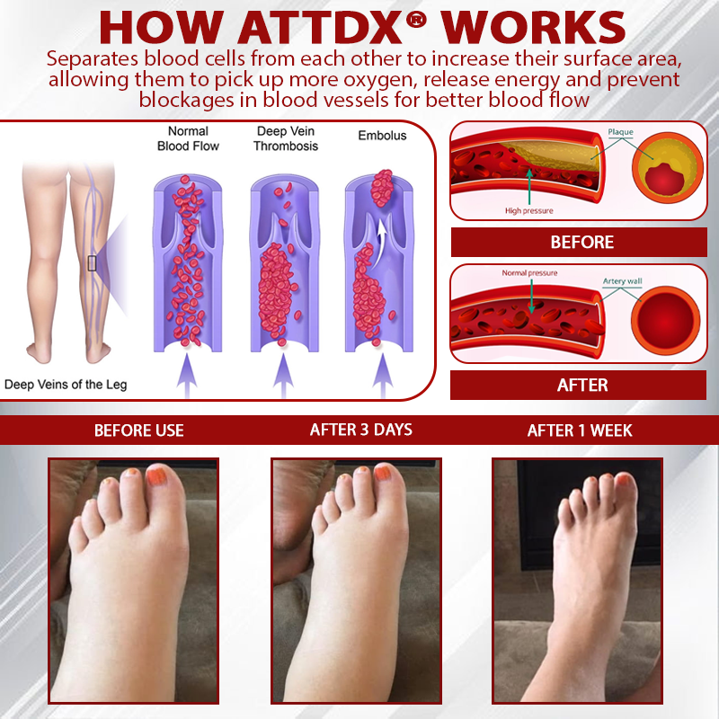 ATTDX® Horse Chestnut LymphoTherm Relief Gel