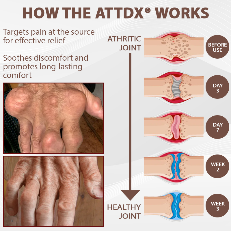 ATTDX® InflameHeal Black Cumin Bone Relief Gel