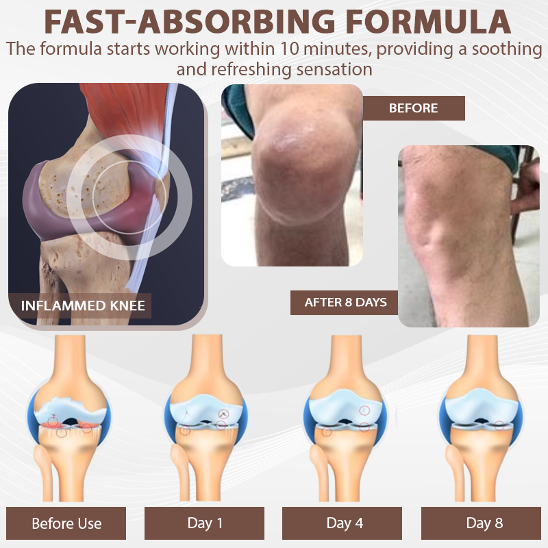 ATTDX® InflameHeal Black Cumin Bone Relief Gel
