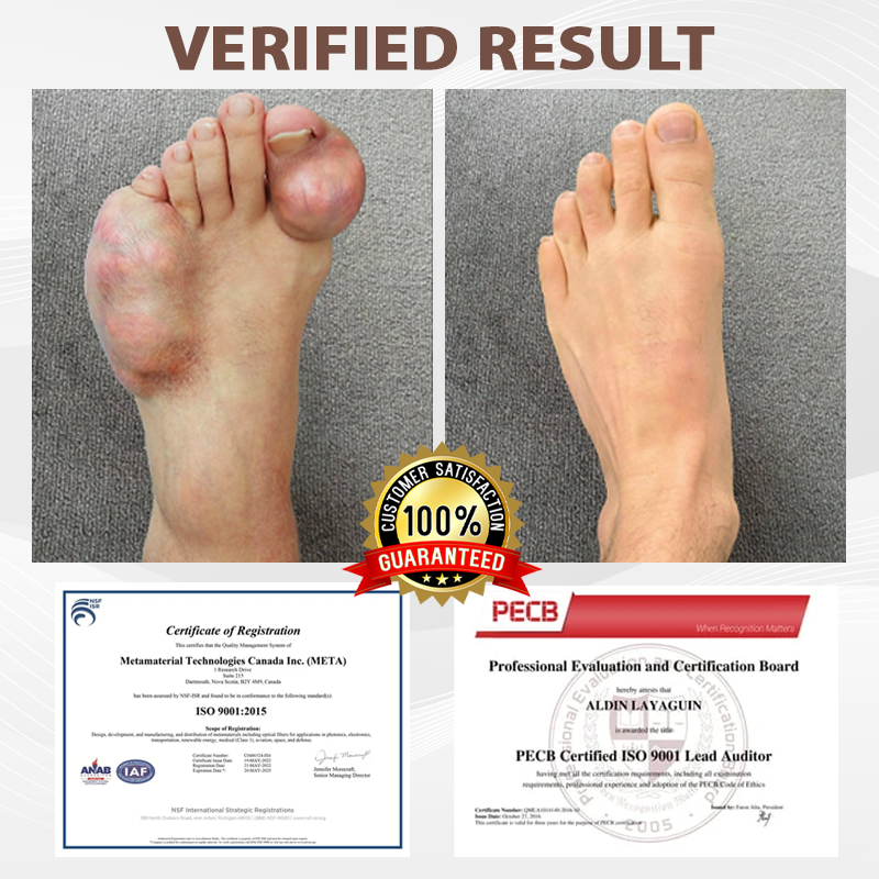 ATTDX® InflameHeal Black Cumin Bone Relief Gel