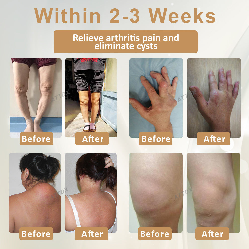 ATTDX® Emu Oil Turmeric Bone Sooth Gel 2