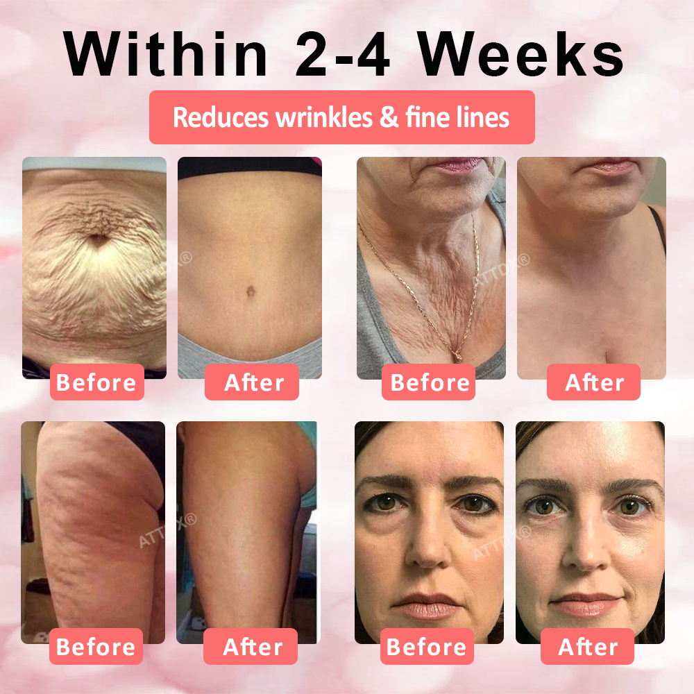 ATTDX® Sakura Collagen Firming Essence Syringe
