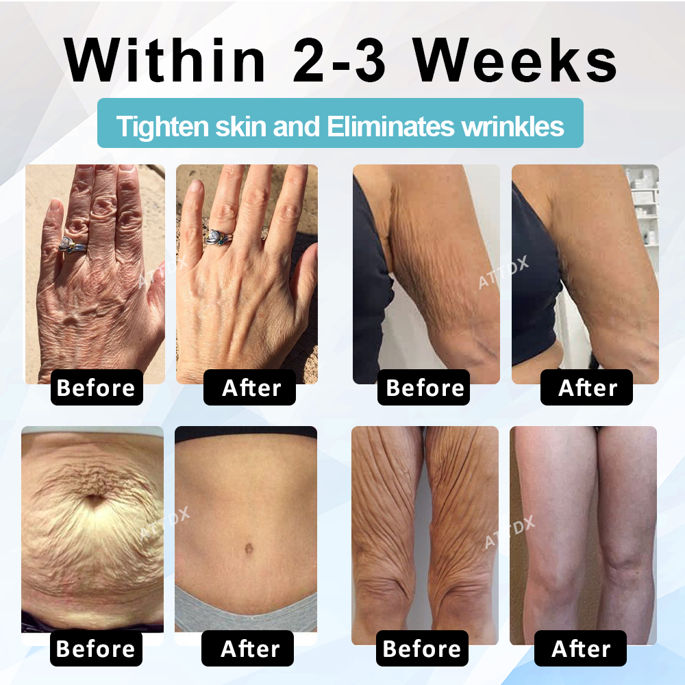 ATTDX™ SkinLift Youthful Firming Body Lotion