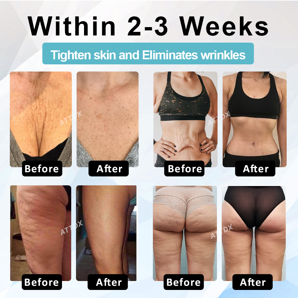 ATTDX™ SkinLift Youthful Firming Body Lotion