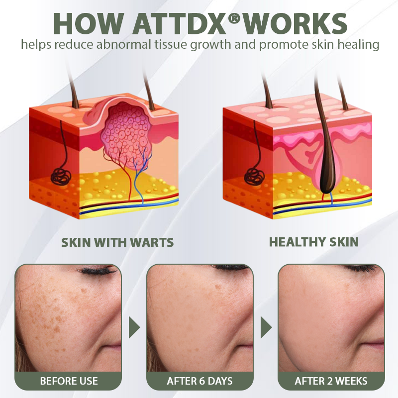 ATTDX® Skin Clear Herbal Jelly Gel