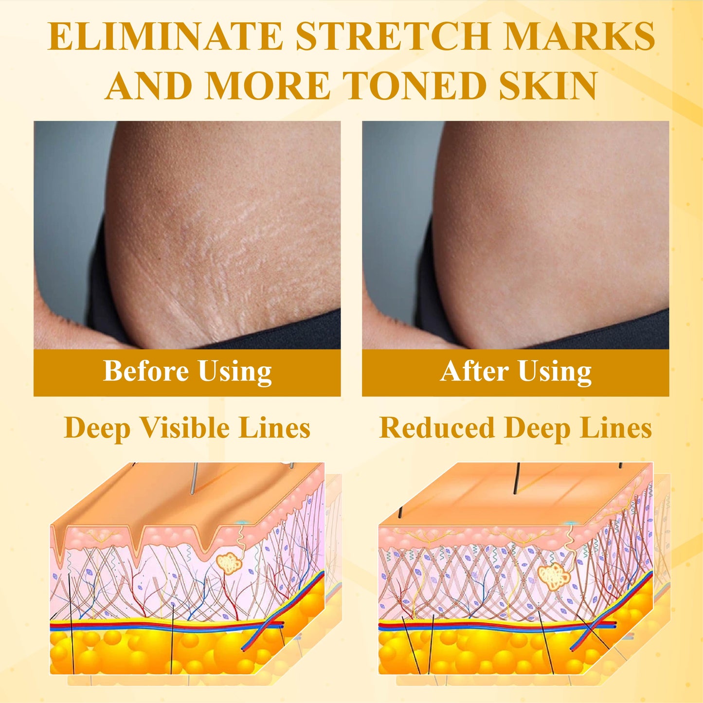 ATTDX® Advanced BotoxBee Multi-Lifting Cream