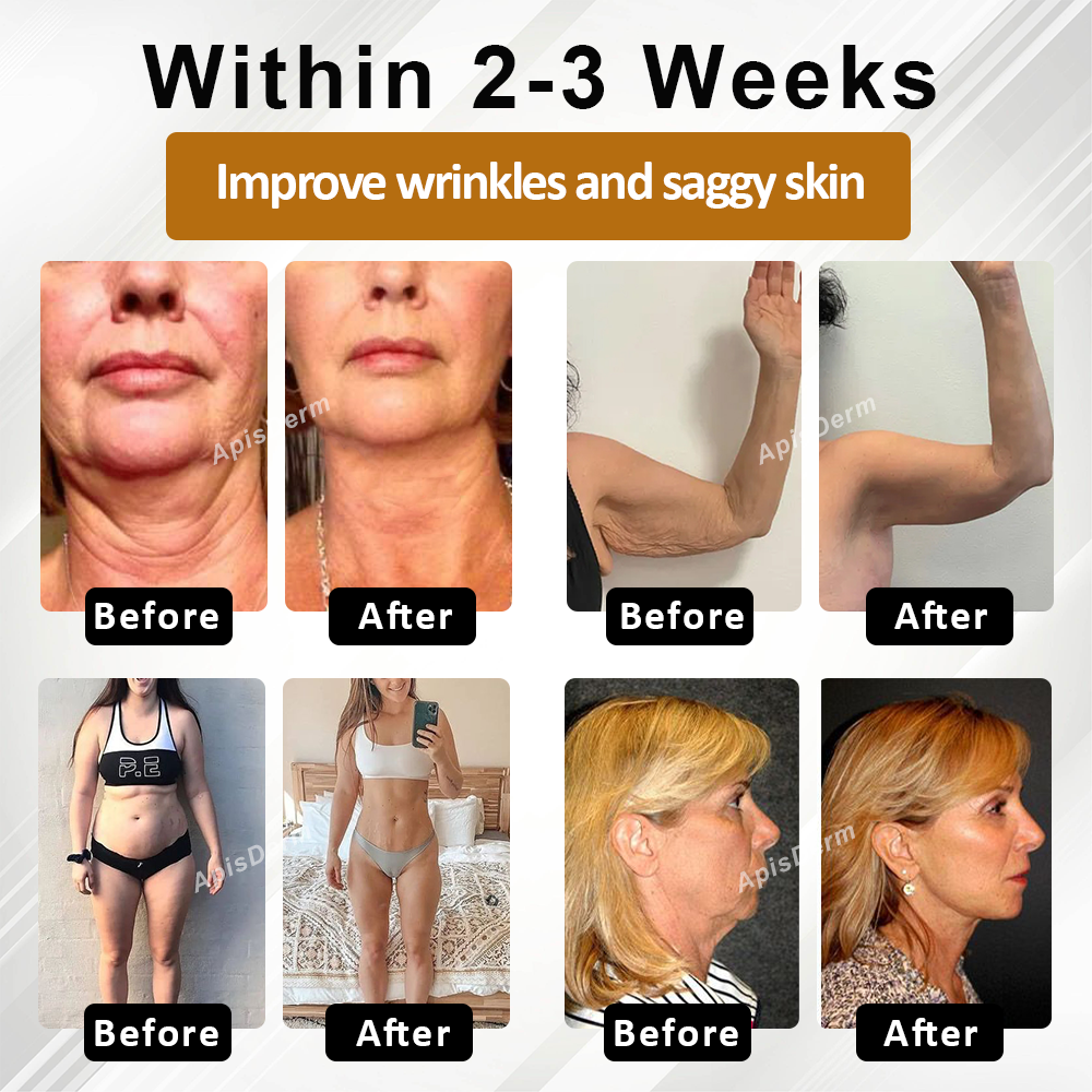 ATTDX® AdvancedSlim Pomegranate Firming Capsule Cream