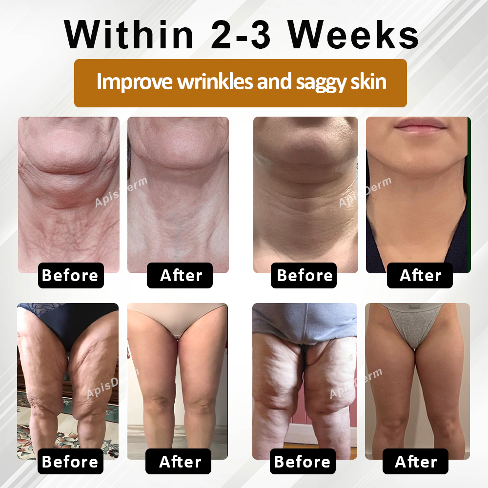 ATTDX® AdvancedSlim Pomegranate Firming Capsule Cream