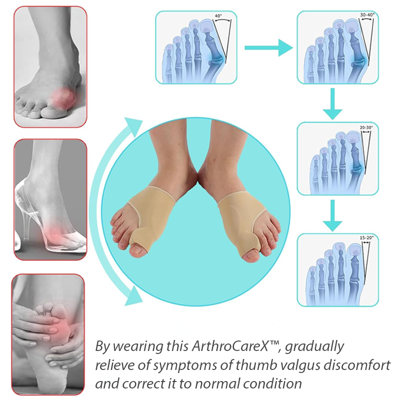 ArthroCareX™ BunionEase Corrector Sock