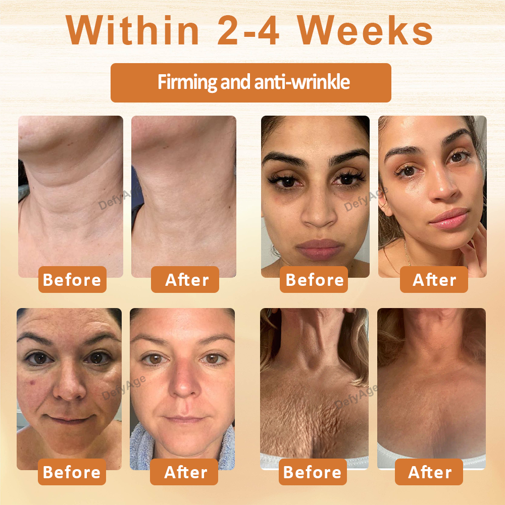 ATTDX® ApiSculpt BotoxAging Cream