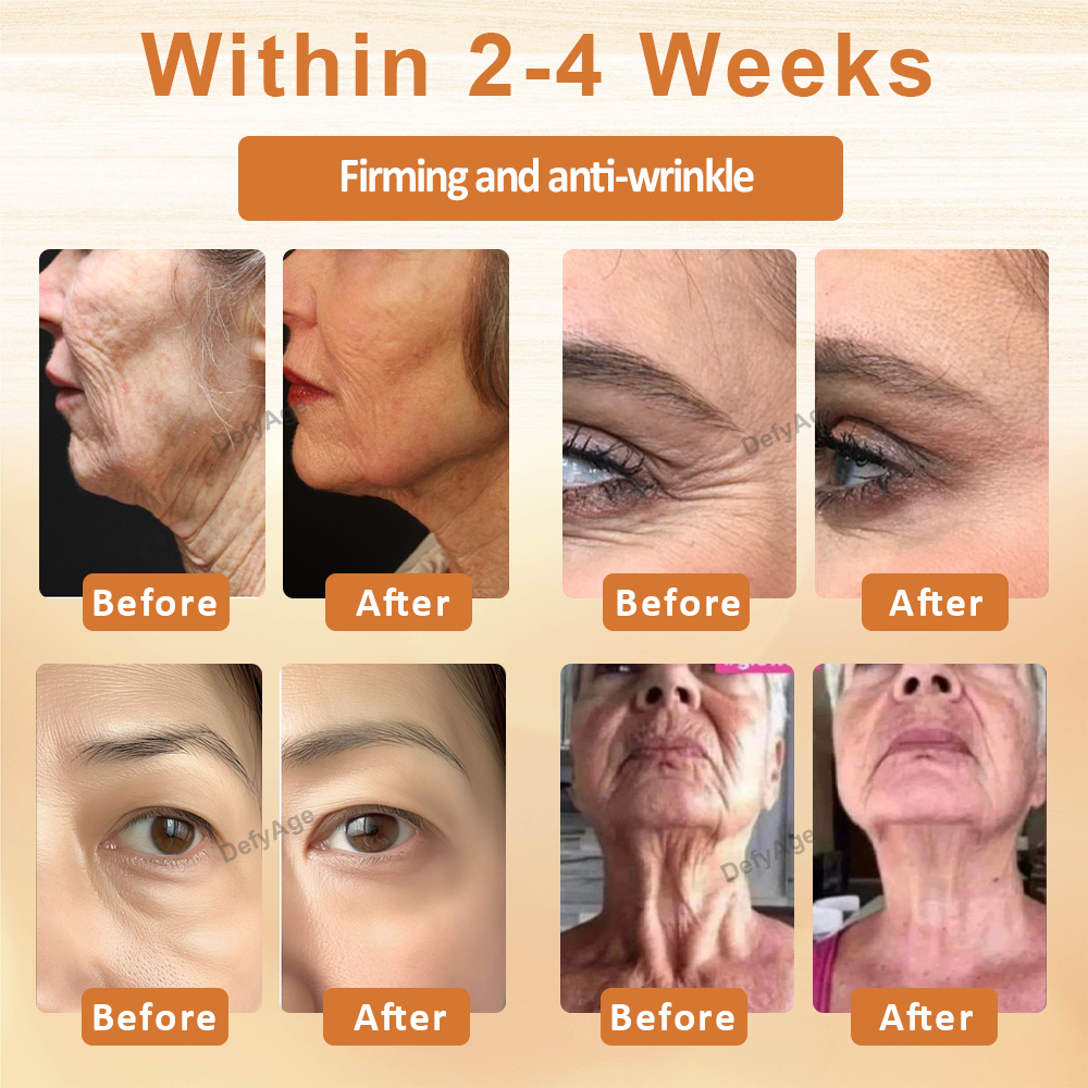 ATTDX® ApiSculpt BotoxAging Cream