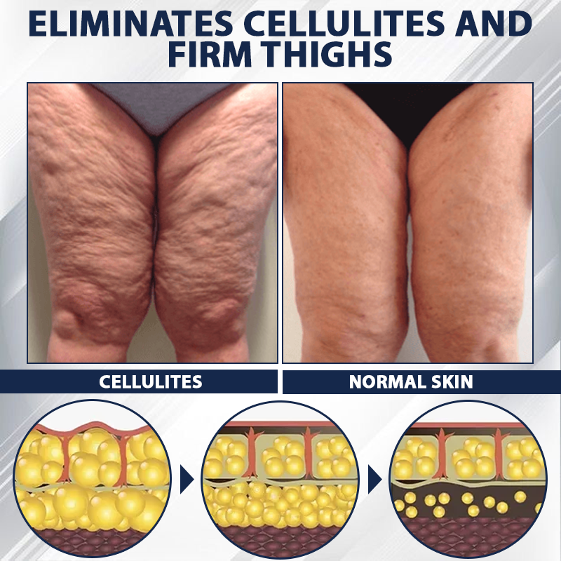 ATTDX™ SkinLift Youthful Firming Body Lotion