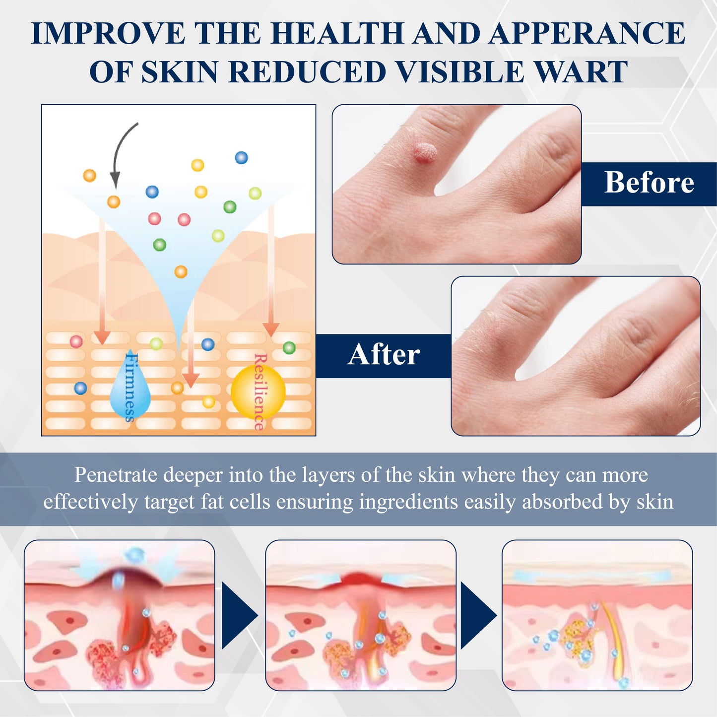 ATTDX® WartsOff Fast-Acting Herbal Cream