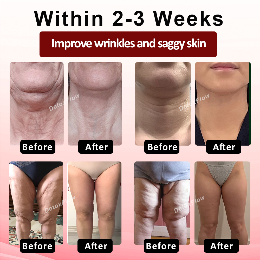 ATTDX® SwellingCare Firming and Sculpting Gel