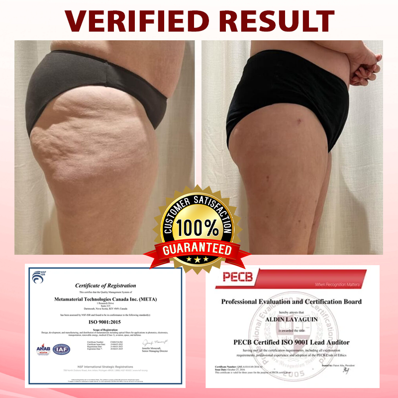 ATTDX® SwellingCare Firming and Sculpting Gel