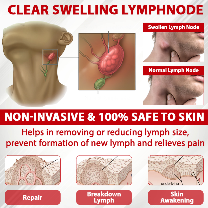 ATTDX® Horse Chestnut LymphoTherm Relief Gel
