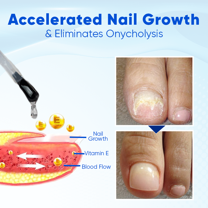 ATTDX® OnyxoGuard Nail Growth and Repair Serum