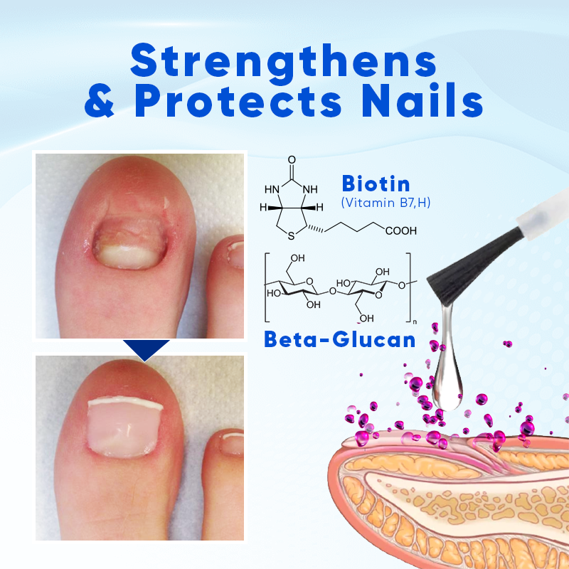 ATTDX® OnyxoGuard Nail Growth and Repair Serum