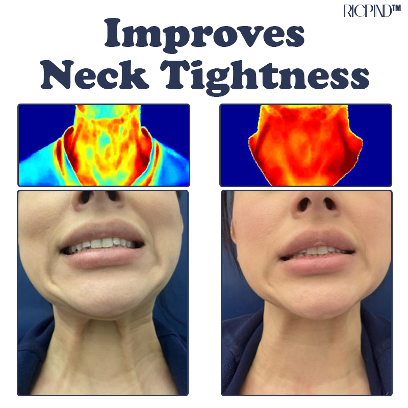 RICPIND™ IONIC Therapy NeckPain ReliefPad