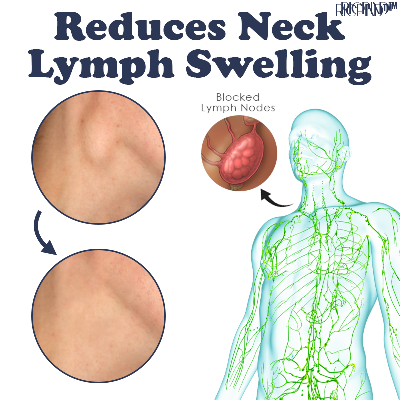 RICPIND™ IONIC Therapy NeckPain ReliefPad