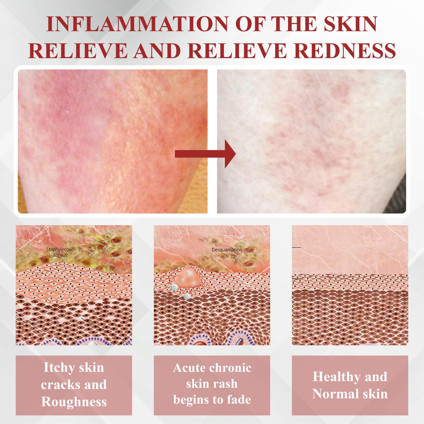 RelievaDerm™ Emu Oil Skin Therapy Botanical Ointment