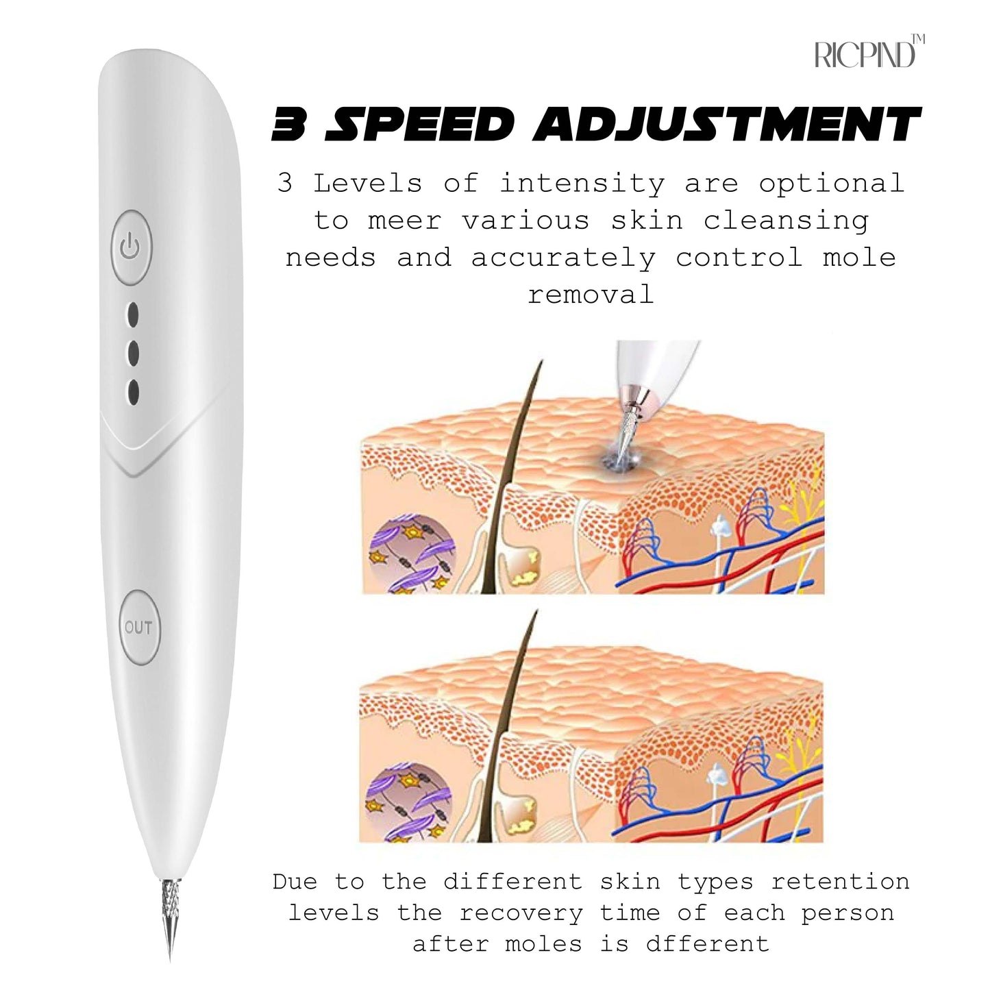RICPIND™ Instant Spot Cleaning Electric Pen