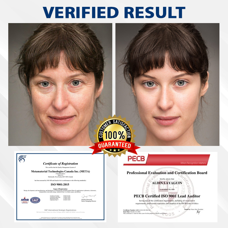 TightenLift™ ApisVenom Blue Tansy WrinkleErase Cream